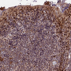 Anti-ZNF85 Antibody