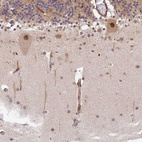 Anti-ZNF85 Antibody