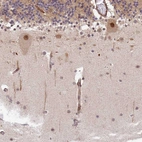 Immunohistochemical staining of human cerebellum shows strong nuclear positivity in Purkinje cells.