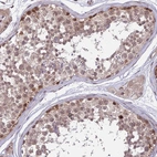 Immunohistochemical staining of human testis shows moderate nuclear positivity in cells in seminiferous ducts.