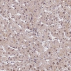 Immunohistochemical staining of human liver shows moderate nuclear positivity in hepatocytes.