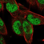 Immunofluorescent staining of human cell line RH-30 shows localization to nucleoplasm.
