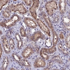Anti-DMRTA1 Antibody