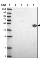 Lane 1: Marker [kDa] 250, 130, 95, 72, 55, 36, 28, 17, 10_br/_Lane 2: Human cell line RT-4_br/_Lane 3: Human cell line U-251MG sp_br/_Lane 4: Human plasma (IgG/HSA depleted)_br/_Lane 5: Human liver tissue