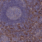 Anti-SNX11 Antibody