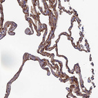 Immunohistochemical staining of human lung shows moderate membranous positivity in pneumocytes.