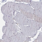Immunohistochemical staining of human skeletal muscle shows no positivity in myocytes as expected.