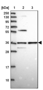 Anti-SNX11 Antibody