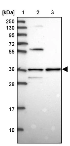 Lane 1: Marker [kDa] 250, 130, 95, 72, 55, 36, 28, 17, 10_br/_Lane 2: Human cell line RT-4_br/_Lane 3: Human cell line U-251MG sp