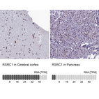 Anti-RSRC1 Antibody