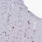Immunohistochemical staining of human cerebral cortex shows high expression.