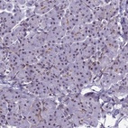 Anti-RSRC1 Antibody