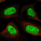 Immunofluorescent staining of human cell line U-2 OS shows localization to nuclear speckles.