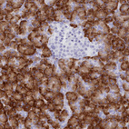 Anti-TMEM97 Antibody