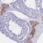 Immunohistochemical staining of human testis shows moderate cytoplasmic positivity in Leydig cells.