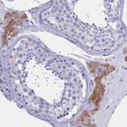 Immunohistochemical staining of human testis shows moderate cytoplasmic positivity in Leydig cells.