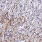 Immunohistochemical staining of human stomach shows moderate cytoplasmic positivity in a subset of glandular cells.