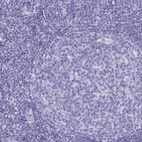 Immunohistochemical staining of human tonsil shows no positivity in lymphoid cells as expected.