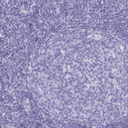 Anti-TMEM97 Antibody