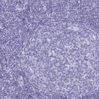 Immunohistochemical staining of human tonsil shows no positivity in lymphoid cells as expected.