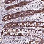 Anti-OCIAD1 Antibody