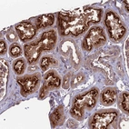 Immunohistochemical staining of human kidney shows strong cytoplasmic positivity in cells in tubules.
