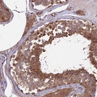 Immunohistochemical staining of human testis shows strong membranous-cytoplasmic positivity in cells in seminiferous ducts.