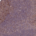 Immunohistochemical staining of human lymphoid tissues shows strong membranous-cytoplasmic positivity in germinal center cells.