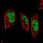 Immunofluorescent staining of human cell line U-251 MG shows localization to nucleoplasm.
