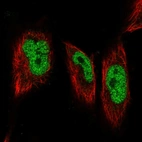 Immunofluorescent staining of human cell line U-251 MG shows localization to nucleoplasm.