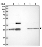 Anti-MXRA7 Antibody