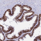 Anti-OR1Q1 Antibody
