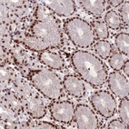 Anti-SH3RF3 Antibody