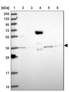 Lane 1: Marker [kDa] 250, 130, 95, 72, 55, 36, 28, 17, 10_br/_Lane 2: Human cell line RT-4_br/_Lane 3: Human cell line U-251MG sp_br/_Lane 4: Human plasma (IgG/HSA depleted)_br/_Lane 5: Human liver tissue_br/_Lane 6: Human tonsil tissue