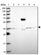 Lane 1: Marker [kDa] 250, 130, 95, 72, 55, 36, 28, 17, 10_br/_Lane 2: Human cell line RT-4_br/_Lane 3: Human cell line U-251MG sp_br/_Lane 4: Human plasma (IgG/HSA depleted)_br/_Lane 5: Human liver tissue_br/_Lane 6: Human tonsil tissue