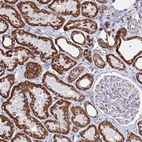 Anti-GLUD1 Antibody