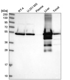 Western blot analysis in human cell line RT-4, human cell line U-251 MG, human plasma, human liver tissue and human tonsil tissue.
