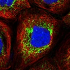Immunofluorescent staining of human cell line A-431 shows localization to mitochondria.