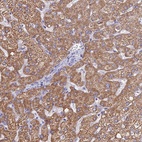 Anti-MGST1 Antibody