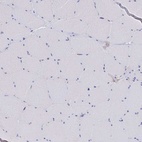 Immunohistochemical staining of human skeletal muscle shows low expression as expected.