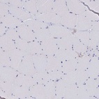 Anti-MGST1 Antibody