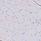 Immunohistochemical staining of human skeletal muscle shows low expression as expected.