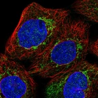 Immunofluorescent staining of human cell line A-431 shows localization to mitochondria.