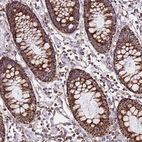 Immunohistochemical staining of human colon shows strong granular cytoplasmic positivity in glandular cells.