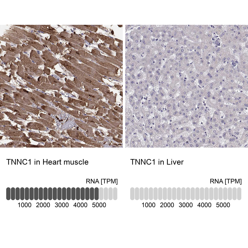 Anti-TNNC1 Antibody