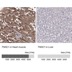 Anti-TNNC1 Antibody