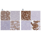 Immunohistochemical staining of human heart muscle, liver, pancreas and skeletal muscle using Anti-TNNC1 antibody HPA044848 (A) shows similar protein distribution across tissues to independent antibody HPA056897 (B).