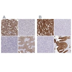 Immunohistochemical staining of human heart muscle, liver, pancreas and skeletal muscle using Anti-TNNC1 antibody HPA044848 (A) shows similar protein distribution across tissues to independent antibody HPA056897 (B).