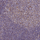 Immunohistochemical staining of human tonsil shows strong granular cytoplasmic positivity in germinal and non germinal center cells.