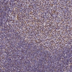Immunohistochemical staining of human tonsil shows strong granular cytoplasmic positivity in germinal and non germinal center cells.